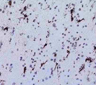 DAB staining of microglia with GPx1S in human brain tissue. Primary antibody (1/400) secondary antibody donkey anti-sheep - biotin (1/3000) followed by Vector ABC kit.