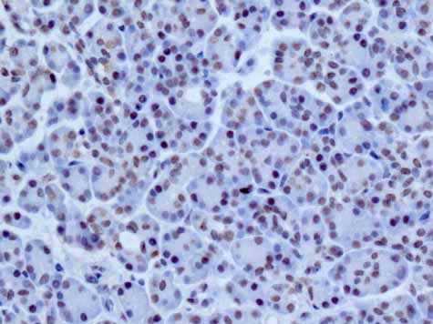 ab167401 showing +ve staining in Human normal pancreas.