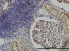 CRTAP antibody (ab56651) used in immunohistochemistry at 3ug/ml on formalin fixed and paraffin embedded human kidney.