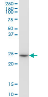 Anti-glutathione S transferase Omega 1 antibody (ab88604) at 1 µg/ml + PC-12 cell lysate at 50 µg