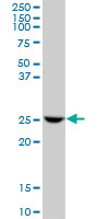Anti-glutathione S transferase Omega 1 antibody (ab88604) at 1 µg/ml + Jurkat cell lysate at 50 µg