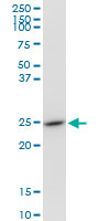 Anti-glutathione S transferase Omega 1 antibody (ab88604) at 1 µg/ml + NIH 3T3 cell lysate at 50 µg