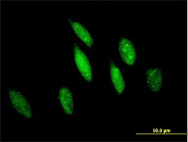 ab88604 at 10µg/ml staining glutathione S transferase Omega 1 in HeLa cells by immunofluorescence.