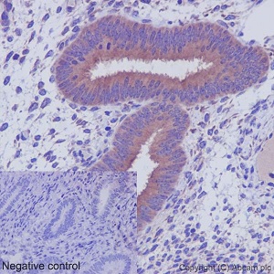 Immunohistochemical analysis of paraffin embedded human endometrial tissue sections labeling CRTAP using ab192261 at a 1/250 dilution. A ready to use HRP Polymer for Rabbit IgG was used as the secondary. Hematoxylin counterstain.