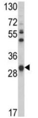 Anti-glutathione S transferase Omega 1 antibody (ab174253) at 1/50 dilution + NCI-H460 cell line lysates at 35 µg