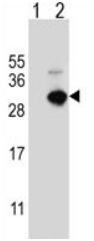 All lanes : Anti-glutathione S transferase Omega 1 antibody (ab174253) at 1/50 dilutionLane 1 : Non-transfected 293 cell lysatesLane 2 : 293 cell lysates transiently transfected with the glutathione S transferase Omega 1 geneLysates/proteins at 2 µg per lane.
