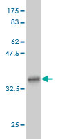 Western blot against tagged recombinant protein immunogen using ab56550 glutathione S transferase Omega 1 antibody at 1ug/ml. 