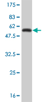Western blot against tagged recombinant protein immunogen using ab55188 Glutathione S Transferase theta 1 antibody at 1ug/ml.