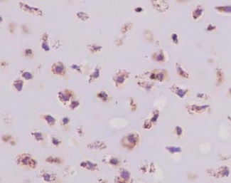 Immunohistochemical analysis of paraffin embedded Human trachea tissue sections labeling CRTAP using ab183720 at a 1/500 dilution. A ready to use HRP Polymer for Rabbit IgG was used as the secondary. Hematoxylin counterstain.
