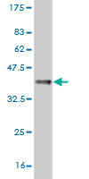 Western blot against tagged recombinant protein immunogen using ab55190 Glutathione S Transferase theta 2 antibody at 1ug/ml.