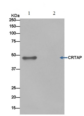 Lysate from SW1353 cells was immunoprecipitated with ab183720 at a 1/50 dilution. For the subsequent blot, ab183720 was used at a 1/1000 dilution with Anti-Rabbit IgG (HRP), specific to the non-reduced form of IgG at a 1/1500 dilution for the secondary. Lane 2: TBS instead of SW1353 lysates. Blocking/ Dilution buffer: 5% NFDM/TBST.