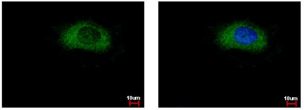 Immunofluorescent analysis of paraformaldehyde-fixed HeLa cells labeling Glycerol 3 Phosphate Dehydrogenase with ab153902 at 1/500 dilution. Right panel co-stained with Hoechst 33343. Cells were fixed with 4% paraformaldehyde at RT for 15 minutes.