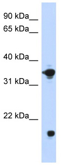 Anti-Glycerol 3 Phosphate Dehydrogenase antibody (ab87286) at 1 µg/ml + transfected 293T cell lysate at 10 µgSecondaryHRP conjugated anti-Rabbit IgG at 1/50000 dilution