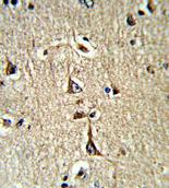 Immunohistochemical analysis of formalin-fixed paraffin-embedded Human brain tissue, labeling Glycerol 3 Phosphate Dehydrogenase using ab175961 at a 1/50 dilution, followed by peroxidase conjugation of the secondary antibody and DAB staining.