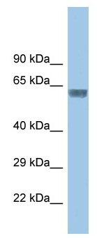 Anti-Glycine Receptor alpha 3 antibody (ab118924) at 1 µg/ml + Mouse small intestine lysate at 10 µg