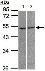 All lanes : Anti-Glycine Receptor alpha 3 antibody (ab137642) at 1/1000 dilutionLane 1 : A431 whole cell lysateLane 2 : Raji whole cell lysateLysates/proteins at 30 µg per lane.