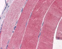 ab117267, at 5 µg/ml, staining Glycogenin 1 in Formalin-fixed, Paraffin-embedded Human Skeletal muscle tissue by Immunohistochemistry.