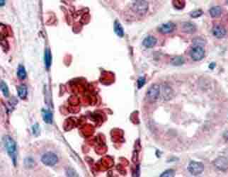 ab40844 at 2µg/ml staining Glycophorin A in human kidney tissue by Immunohistochemistry (Formalin/PFA-fixed paraffin-embedded sections). Steamed antigen retrieval with citrate buffer pH 6 was performed, AP-staining.Image shows bright staining of erythrocytes.