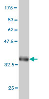 Western blot against tagged recombinant protein immunogen using ab55222 Glycophorin C antibody at 1ug/ml.