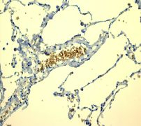 Immunohistochemical staining of paraffin-embedded human lung tissue using ab108925 at a dilution of 1/100.