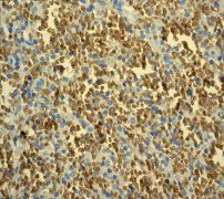 Immunohistochemical staining of paraffin-embedded human spleen tissue using ab108925 at a dilution of 1/100.