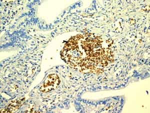 ab108925 showing positive staining in Normal ovary erythrocytes tissue.