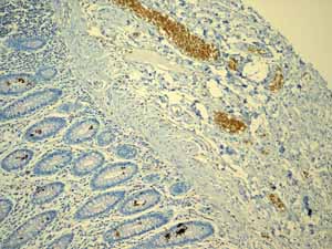 ab108925 showing positive staining in Normal colon erythrocytes tissue.