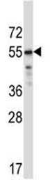 Anti-CRTR1 antibody (ab171839) + WiDr cell line lysate at 35 µg