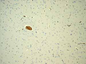 ab108925 showing positive staining in Normal brain erythrocytes tissue.