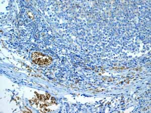ab108925 showing positive staining in Normal tonsil erythrocytes tissue.