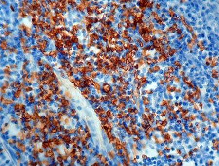 Immunohistochemical analysis of formalin-fixed, paraffin-embedded Human tonsil tissue, staining Glycophorin C with ab9521.