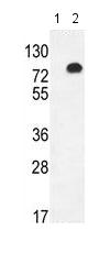 All lanes : Anti-Glypican 6 antibody (ab170523) at 1/50 dilutionLane 1 : Non-transfected 293 cell lysateLane 2 : Glypican 6-transfected 293 cell lysateLysates/proteins at 2 µg per lane.