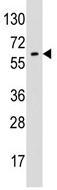 Anti-Glypican 6 antibody (ab71343) at 1/60 dilution + K562 cell line lysate at 35 µg