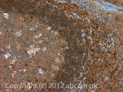 IHC image of GM-CSF staining in Human normal tonsil formalin fixed paraffin embedded tissue section, performed on a Leica BondTM system using the standard protocol F. The section was pre-treated using heat mediated antigen retrieval with sodium citrate buffer (pH6, epitope retrieval solution 1) for 20 mins. The section was then incubated with ab9741, 5µg/ml, for 15 mins at room temperature and detected using an HRP conjugated compact polymer system. DAB was used as the chromogen. The section was then counterstained with haematoxylin and mounted with DPX.For other IHC staining systems (automated and non-automated) customers should optimize variable parameters such as antigen retrieval conditions, primary antibody concentration and antibody incubation times.