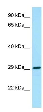 Anti-GM-CSF Receptor alpha antibody (ab128624) at 1 µg/ml + Human fetal heart lysate at 10 µg
