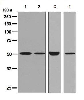 All lanes : Anti-GM-CSF Receptor alpha antibody [ EPR8808] (ab133678) at 1/1000 dilutionLane 1 : 293T cell lysateLane 2 : THP1 cell lysate Lane 3 : HepG2 cell lysate Lane 4 : Human placenta lysate Lysates/proteins at 10 µg per lane.SecondaryGoat anti-rabbit HRP conjugated antibody at 1/2000 dilution