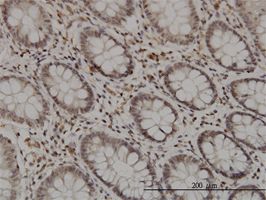 GMEB1 antibody (ab56973) used in immunohistochemistry at 3ug/ml on formalin fixed and paraffin embedded human colon.