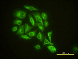 GMF beta antibody (ab55063) used in immunofluorescence at 10ug/ml on HeLa cells.