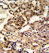 Immunohistochemical analysis of Formalin-fixed, paraffin-embedded Human kidney tissue labelling GMP Synthase with ab135701 at 1/50 dilution followed by peroxidase-conjugated secondary antibody and DAB staining.