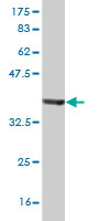 Western blot against tagged recombinant protein immunogen using ab57111 GMMPA antibody at 1ug/ml.
