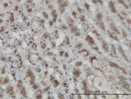 GMPPB antibody (ab57109) used in immunohistochemistry at 3ug/ml on formalin fixed and paraffin embedded human adrenal gland.