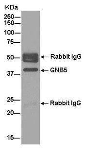 Western blot analysis of GNB5 in immunoprecipitation pellets from Rat brain lysate using ab185206 at 1/50 dilution. Secondary antibody Goat Anti-Rabbit IgG, (H+L), Peroxidase conjugated at 1/1000.