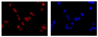 Immunofluorescent analysis of 4% paraformaldehyde-fixed U87-MG cells labeling GNB5 with ab185206 at 1/100 dilution. Secondary antibody: Goat anti rabbit IgG (Alexa Fluor®555) at 1/200 dilution. Counterstained with Dapi blue.