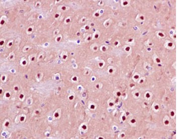 Immunohistochemical analysis of paraffin-embedded Mouse brain tissue labeling GNB5 with ab185206 at 1/250 dilution followed by pre-diluted HRP-conjugated secondary antibody and counter-stained with Hematoxylin.