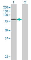 All lanes : Anti-GNL1 antibody (ab67669) at 1/500 dilutionLane 1 : GNL1 transfected 293T cell lysateLane 2 : Non transfected 293T cell lysateLysates/proteins at 25 µg per lane.SecondaryGoat Anti-Mouse IgG (H&L)-HRP Conjugate at 1/2500 dilution