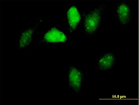 ab67669 at 10µg/ml staining GNL1 in Hela cells.