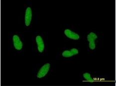 ab88291, at 10 µg/ml, staining Gonadotropin Inducible Transcription Repressor 1 in HepG2 cell by Immunofluorescence.