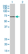 All lanes : Anti-Gonadotropin Inducible Transcription Repressor 1 antibody (ab168178) at 1/500 dilutionLane 1 : Gonadotropin Inducible Transcription Repressor 1 transfected 293T cell lysateLane 2 : Non-transfected 293T cell lysateLysates/proteins at 15 µl per lane.SecondaryGoat anti-Mouse IgG HRP at 1/2500 dilution