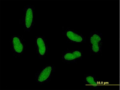 Immunofluorescent analysis of HepG2 cells labeling Gonadotropin Inducible Transcription Repressor 1 with ab168178 at 10 µg/ml.Protein A purification is required before use in this application.