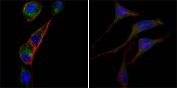Immunofluorescence analysis of PC-3 (left) and SK-BR-3 (right) cells using ab93928 (green) at 100-400 dilution. Red: Actin filaments have been labeled with DY-554 phalloidin. Blue: DRAQ5 fluorescent DNA dye.